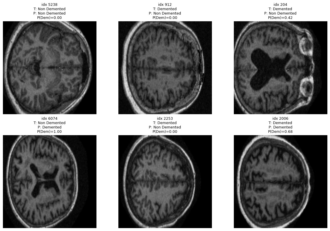 Grid of MRI brain scans with model predictions: true label, predicted label, and probability of dementia for each scan